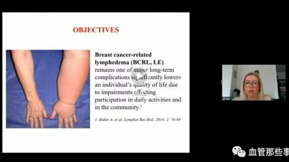 ICC 2020年度线上学术会议 静脉淋巴学和压力治疗第二期第二课程
